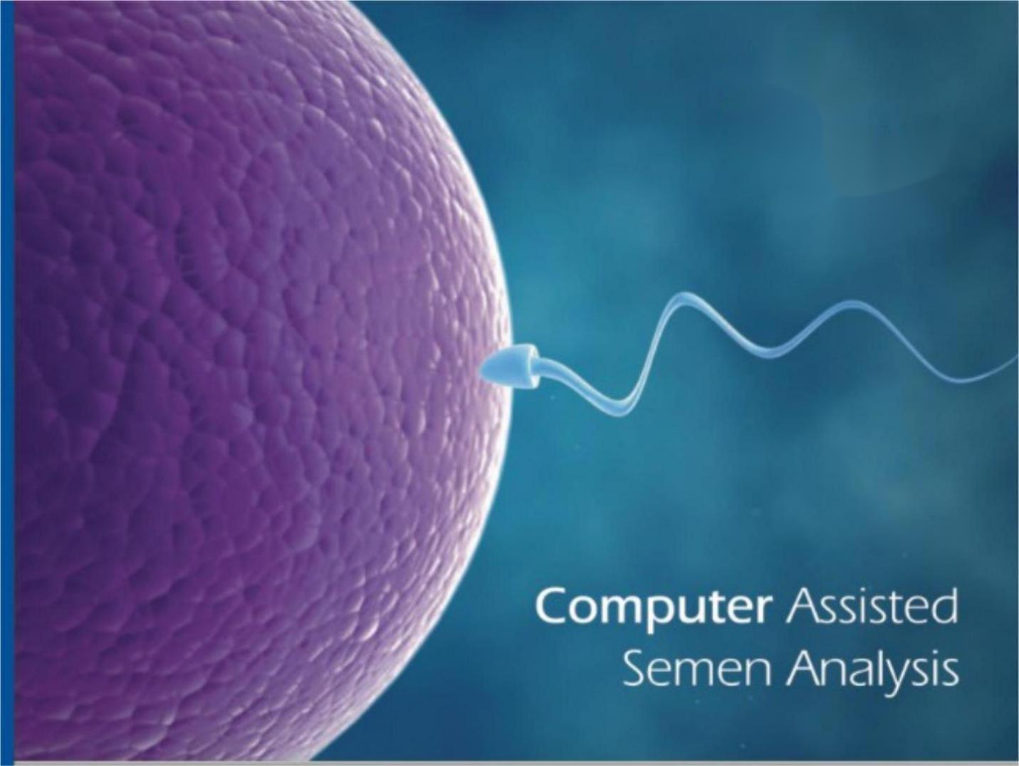 How to choose China brand Fully Automated CASA Sperm Quality Analysis Software System
